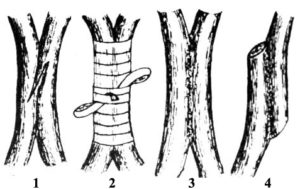Способы прививки плодовых деревьев весной: выбираем оптимальный